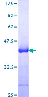 NCAM / CD56 Protein - 12.5% SDS-PAGE Stained with Coomassie Blue.