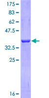 NCAM2 Protein - 12.5% SDS-PAGE Stained with Coomassie Blue.