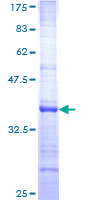 NCAN / Neurocan Protein - 12.5% SDS-PAGE Stained with Coomassie Blue.