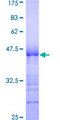 NCAPG / HCAP-G Protein - 12.5% SDS-PAGE Stained with Coomassie Blue.