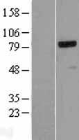 NCAPH / CAP-H Protein - Western validation with an anti-DDK antibody * L: Control HEK293 lysate R: Over-expression lysate
