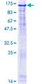 NCAPH / CAP-H Protein - 12.5% SDS-PAGE of human NCAPH stained with Coomassie Blue
