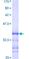 NCAPH / CAP-H Protein - 12.5% SDS-PAGE Stained with Coomassie Blue.