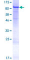 NCAPH2 / CAP-H2 Protein - 12.5% SDS-PAGE of human NCAPH2 stained with Coomassie Blue