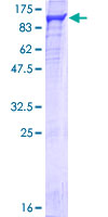 NCBP1 / CBP80 Protein - 12.5% SDS-PAGE of human NCBP1 stained with Coomassie Blue