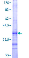NCBP1 / CBP80 Protein - 12.5% SDS-PAGE Stained with Coomassie Blue.