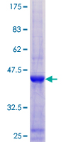 NCBP2 / CBP20 Protein - 12.5% SDS-PAGE of human NCBP2 stained with Coomassie Blue