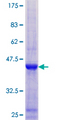 NCBP2 / CBP20 Protein - 12.5% SDS-PAGE of human NCBP2 stained with Coomassie Blue
