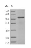 NCBP2 / CBP20 Protein - (Tris-Glycine gel) Discontinuous SDS-PAGE (reduced) with 5% enrichment gel and 15% separation gel.