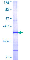 NCBP2 / CBP20 Protein - 12.5% SDS-PAGE Stained with Coomassie Blue.
