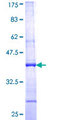 NCBP2 / CBP20 Protein - 12.5% SDS-PAGE Stained with Coomassie Blue.