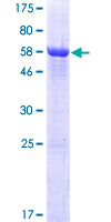 NCCRP1 Protein - 12.5% SDS-PAGE of human LOC342897 stained with Coomassie Blue