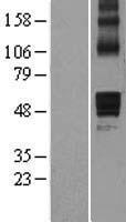 NCEH1 / AADACL1 Protein - Western validation with an anti-DDK antibody * L: Control HEK293 lysate R: Over-expression lysate