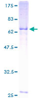 NCEH1 / AADACL1 Protein - 12.5% SDS-PAGE of human AADACL1 stained with Coomassie Blue