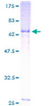 NCEH1 / AADACL1 Protein - 12.5% SDS-PAGE of human AADACL1 stained with Coomassie Blue