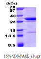 NCEH1 / AADACL1 Protein
