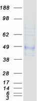 NCEH1 / AADACL1 Protein - Purified recombinant protein NCEH1 was analyzed by SDS-PAGE gel and Coomassie Blue Staining