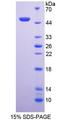 NCF1 / p47phox / p47 phox Protein - Recombinant  Neutrophil Cytosolic Factor 1 By SDS-PAGE
