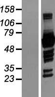 NCF2 / NOXA2 / p67phox Protein - Western validation with an anti-DDK antibody * L: Control HEK293 lysate R: Over-expression lysate