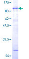 NCF2 / NOXA2 / p67phox Protein - 12.5% SDS-PAGE of human NCF2 stained with Coomassie Blue