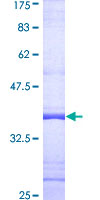 NCF2 / NOXA2 / p67phox Protein - 12.5% SDS-PAGE Stained with Coomassie Blue.