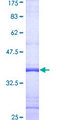 NCF2 / NOXA2 / p67phox Protein - 12.5% SDS-PAGE Stained with Coomassie Blue.