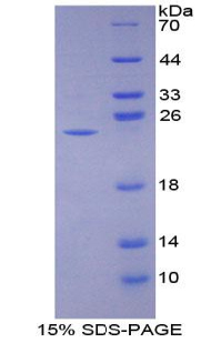 NCF2 / NOXA2 / p67phox Protein - Recombinant Neutrophil Cytosolic Factor 2 By SDS-PAGE