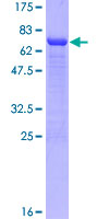NCK1 / NCK Protein - 12.5% SDS-PAGE of human NCK1 stained with Coomassie Blue