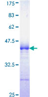 NCK1 / NCK Protein - 12.5% SDS-PAGE Stained with Coomassie Blue.