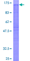 NCKAP1 / NAP125 Protein - 12.5% SDS-PAGE of human NCKAP1 stained with Coomassie Blue