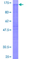 NCKAP1 / NAP125 Protein - 12.5% SDS-PAGE of human NCKAP1 stained with Coomassie Blue
