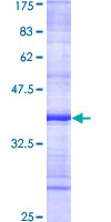 NCKAP1 / NAP125 Protein - 12.5% SDS-PAGE Stained with Coomassie Blue.
