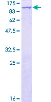 NCKIPSD / AF3P21 Protein - 12.5% SDS-PAGE of human NCKIPSD stained with Coomassie Blue