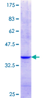 NCKIPSD / AF3P21 Protein - 12.5% SDS-PAGE Stained with Coomassie Blue.