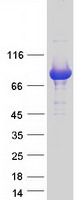 NCKIPSD / AF3P21 Protein - Purified recombinant protein NCKIPSD was analyzed by SDS-PAGE gel and Coomassie Blue Staining