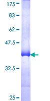 NCLN Protein - 12.5% SDS-PAGE Stained with Coomassie Blue.