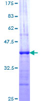 NCOA1 / SRC-1 Protein - 12.5% SDS-PAGE Stained with Coomassie Blue.
