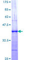 NCOA1 / SRC-1 Protein - 12.5% SDS-PAGE Stained with Coomassie Blue.