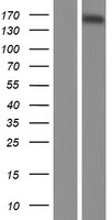 NCOA3 / SRC-3 / AIB1 Protein - Western validation with an anti-DDK antibody * L: Control HEK293 lysate R: Over-expression lysate