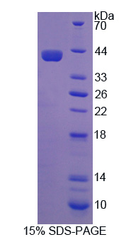 NCOA3 / SRC-3 / AIB1 Protein - Recombinant Nuclear Receptor Coactivator 3 By SDS-PAGE