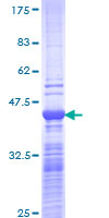 NCOA6 / ASC-2 Protein - 12.5% SDS-PAGE Stained with Coomassie Blue.