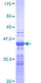 NCOA6 / ASC-2 Protein - 12.5% SDS-PAGE Stained with Coomassie Blue.