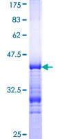 NCOR2 / SMRT Protein - 12.5% SDS-PAGE Stained with Coomassie Blue.
