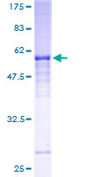 NCR1 / NKP46 Protein - 12.5% SDS-PAGE of human NCR1 stained with Coomassie Blue