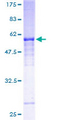 NCR1 / NKP46 Protein - 12.5% SDS-PAGE of human NCR1 stained with Coomassie Blue