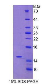 NCR2 / NKP44 Protein - Recombinant Natural Cytotoxicity Triggering Receptor 2 By SDS-PAGE