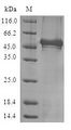 NCS1 / Neuronal Calcium Sensor Protein - (Tris-Glycine gel) Discontinuous SDS-PAGE (reduced) with 5% enrichment gel and 15% separation gel.