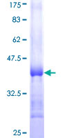 NCSTN / Nicastrin Protein - 12.5% SDS-PAGE Stained with Coomassie Blue.