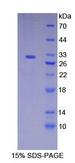 NCSTN / Nicastrin Protein - Recombinant Nicastrin By SDS-PAGE