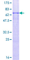 NDN / Necdin Protein - 12.5% SDS-PAGE of human NDN stained with Coomassie Blue